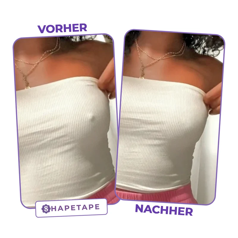 Silikon-Nippelabdeckungen – ohne Klebeschicht